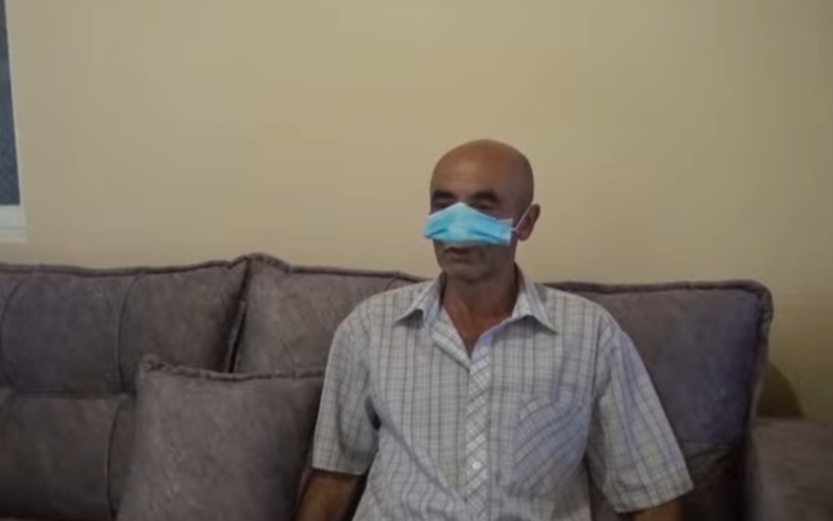 Şəkidə it kişinin burnunu DİŞLƏDİ