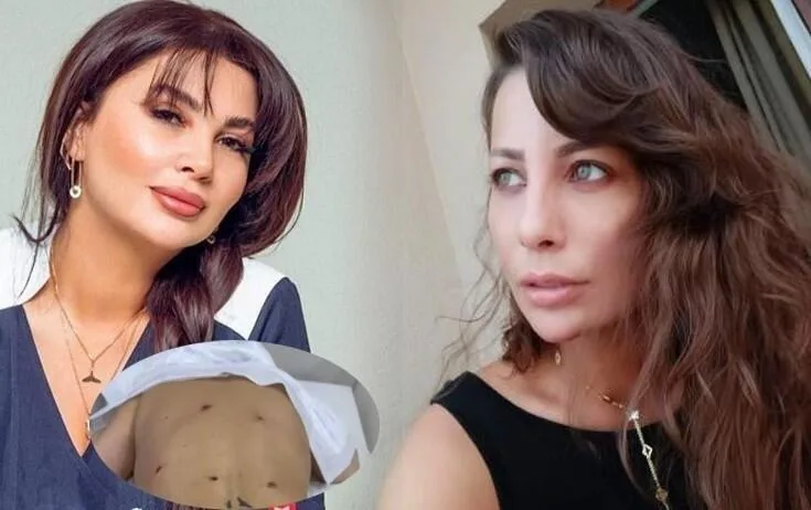 Aktrisaya görə Ülviyyə İlyasovanın cəzası artırıldı