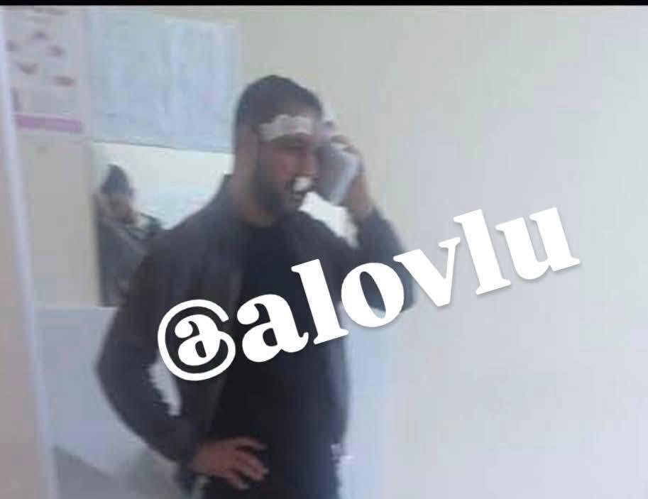 Qəbələdə döyülən “Çevik” adlı tiktokerin vəkilindən açıqlama - FOTO