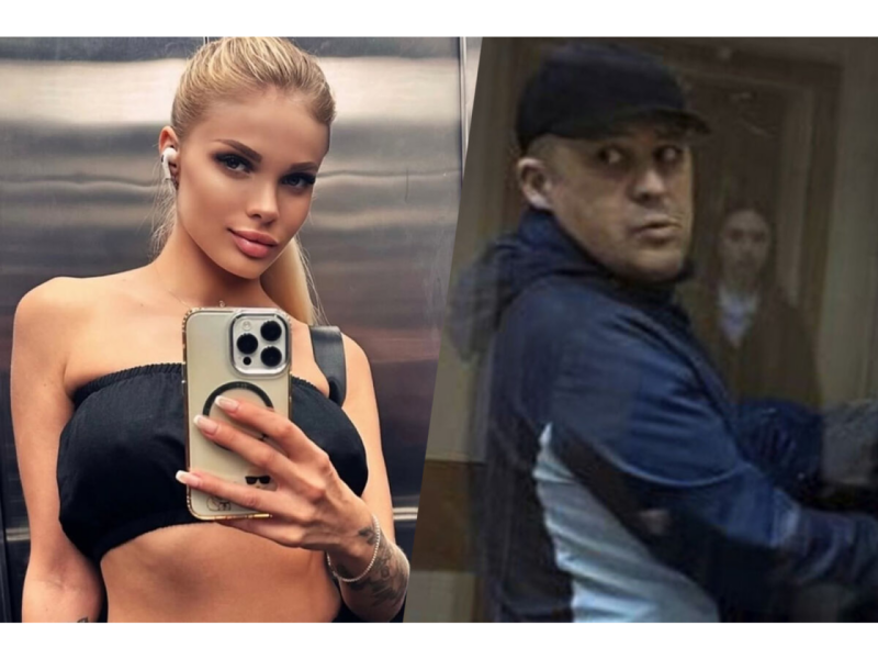 Model sevgilisi tərəfindən vəhşicəsinə döyüldü – Kəllə sümüyünün yarısını itirib