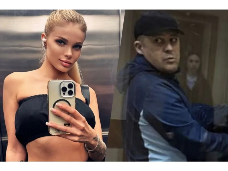 Model sevgilisi tərəfindən vəhşicəsinə döyüldü – Kəllə sümüyünün yarısını itirib