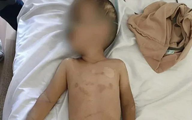 Lənkəranda 3 yaşlı uşağa zorakılıq edən ögey ata saxlanıldı