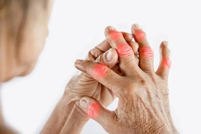 Revmatoid artritlə yaşayanlar nələrə diqqət etməlidir? - SN-nin revmatoloqundan tövsiyələr